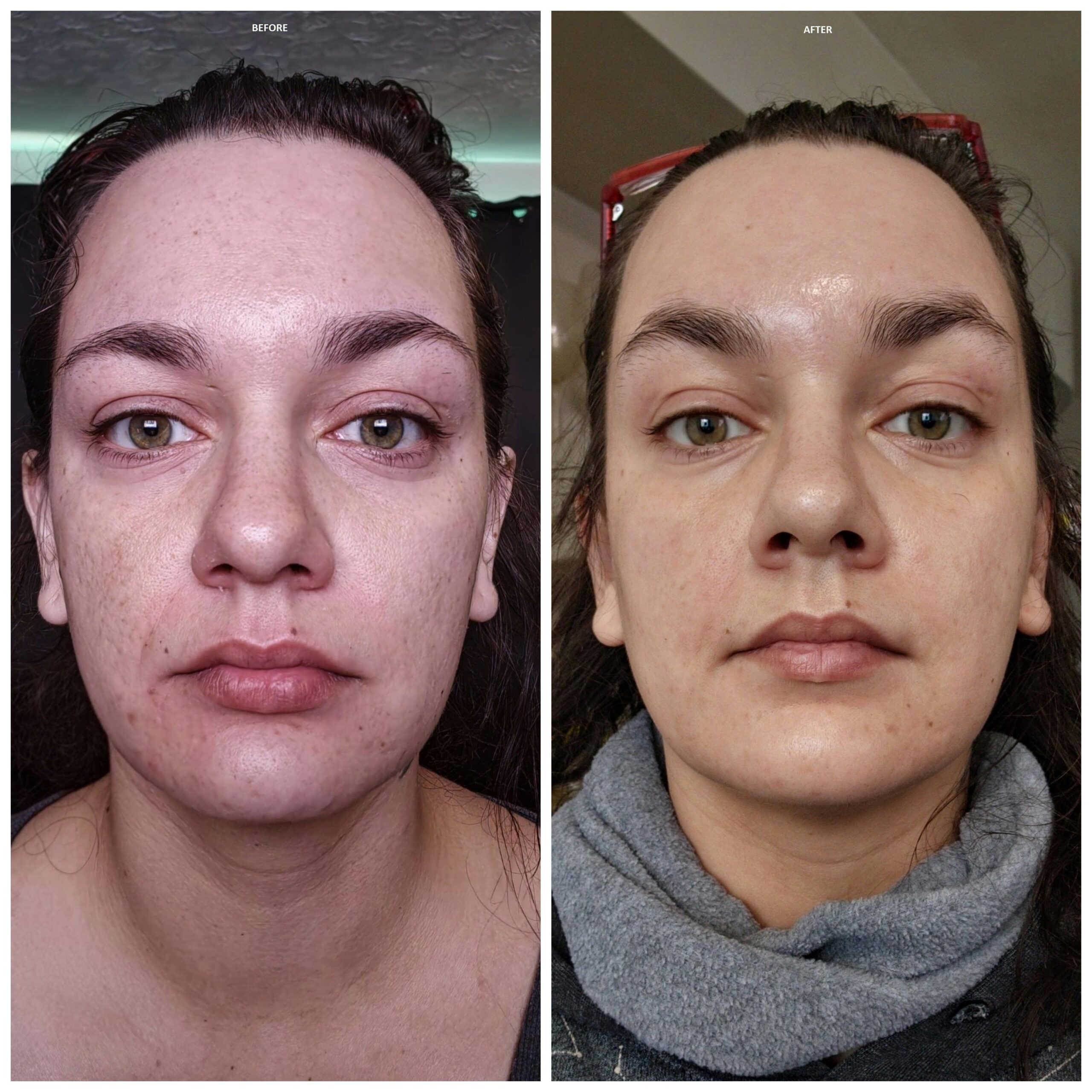Customer review photo