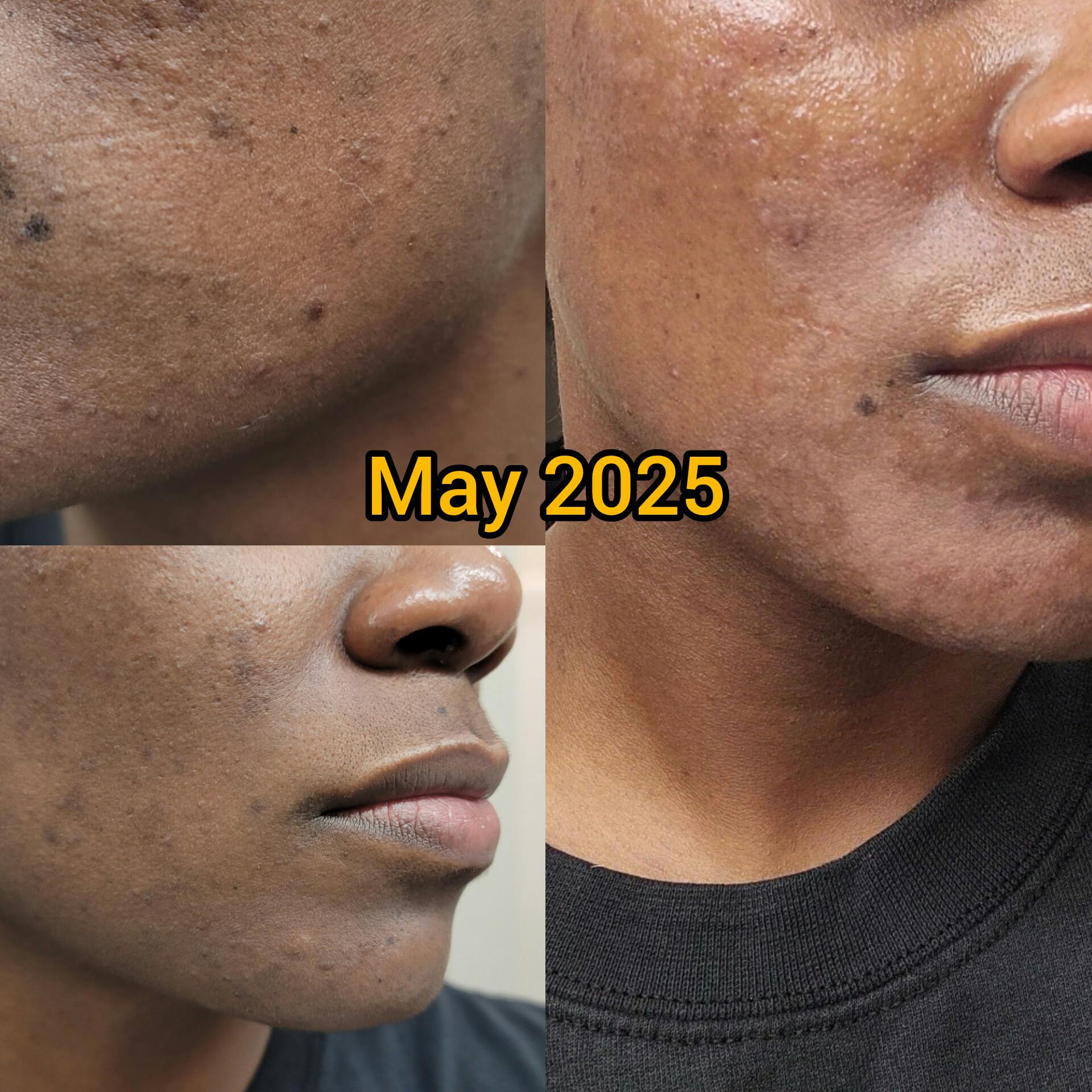 Customer review photo