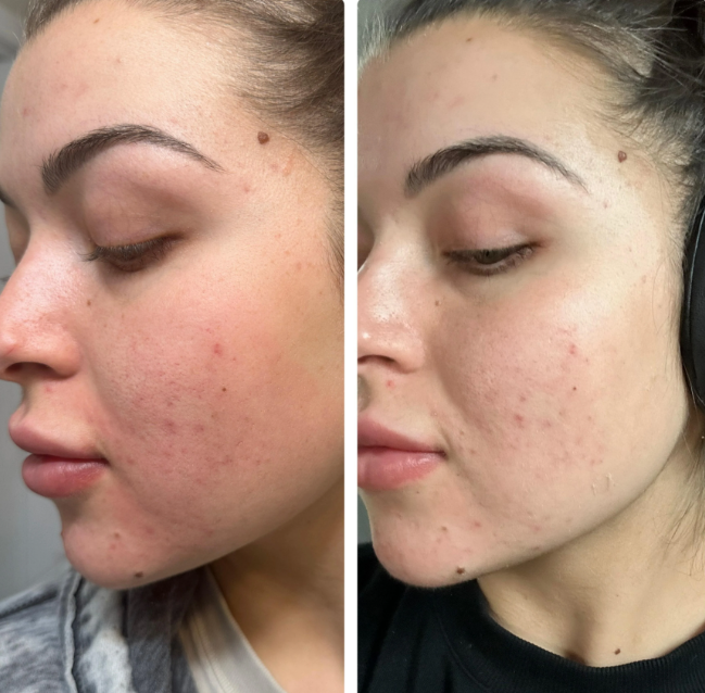 Customer review photo