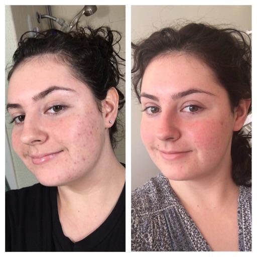 Customer review photo