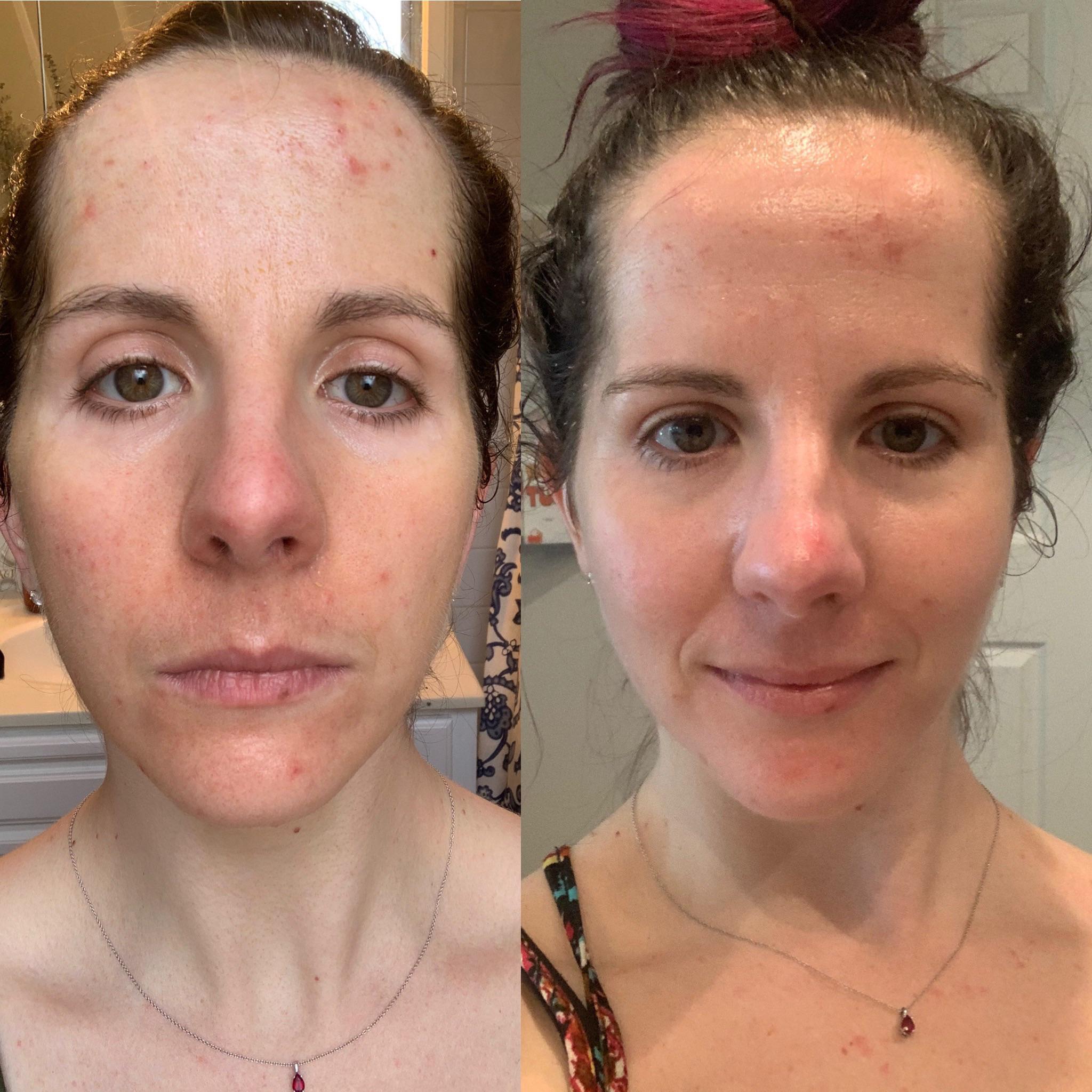 Customer review photo