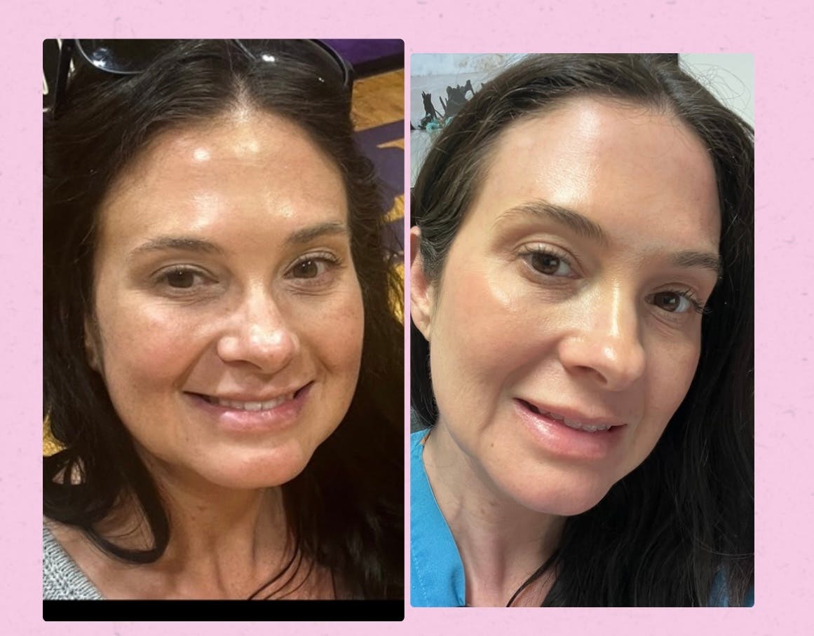 Customer review photo
