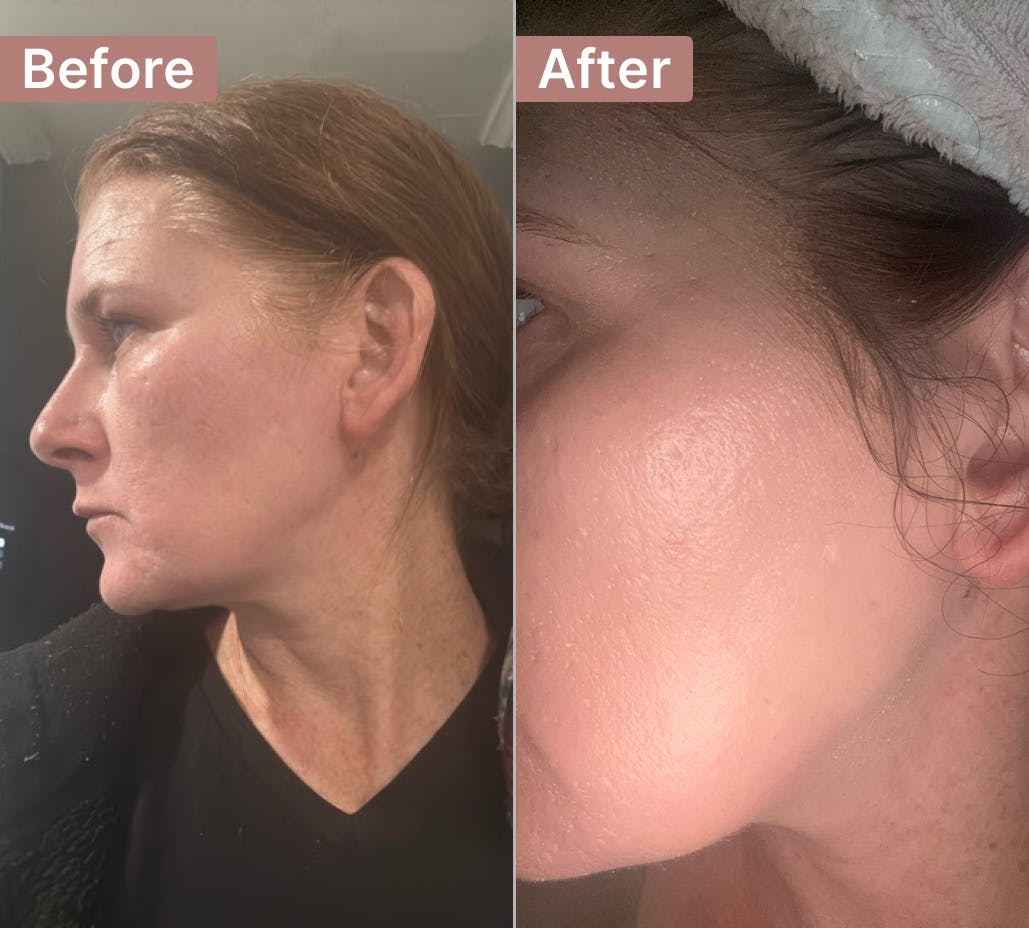Customer review photo