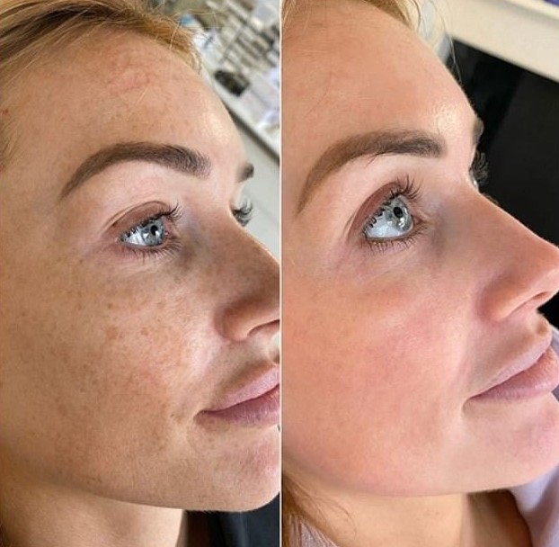 Customer review photo