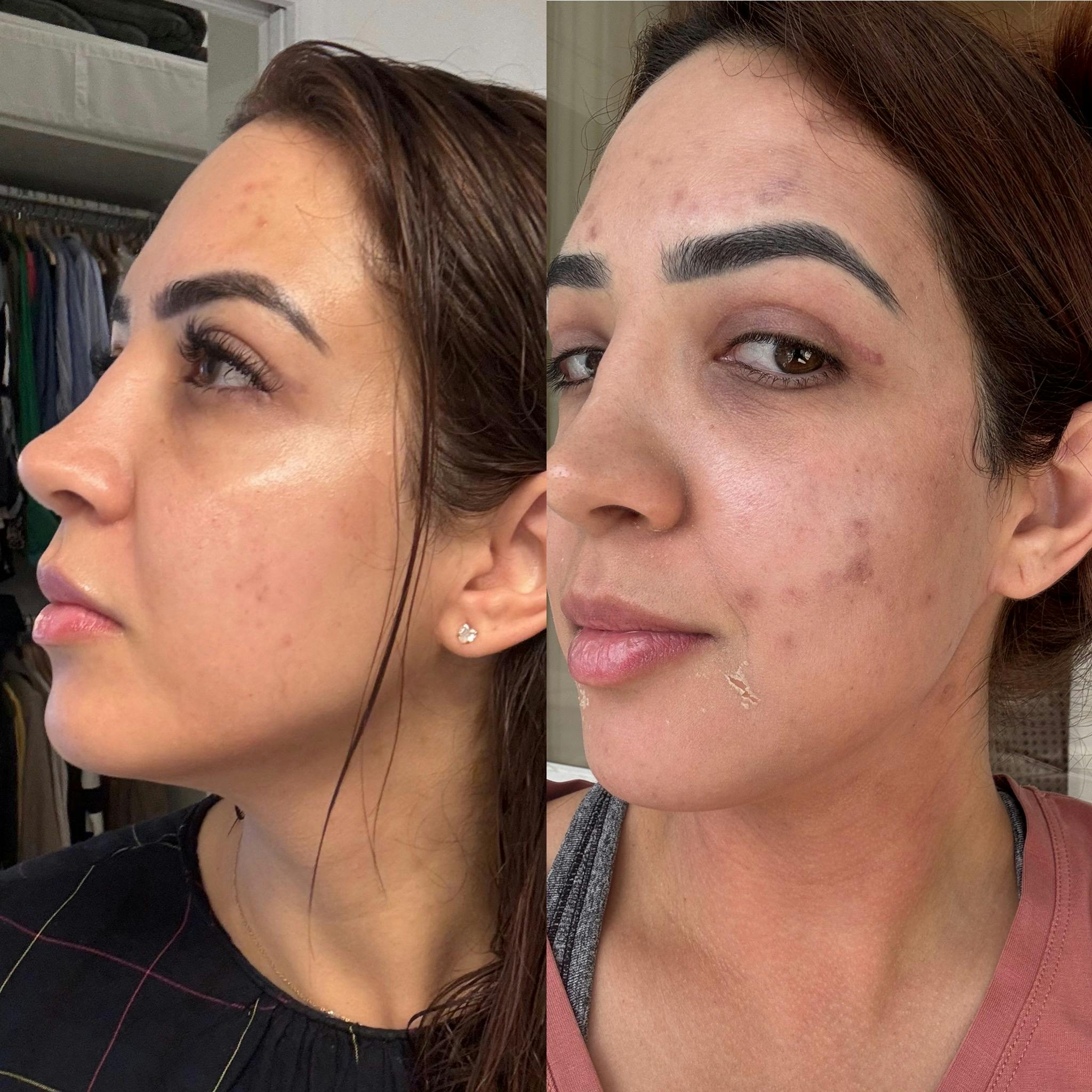 Customer review photo