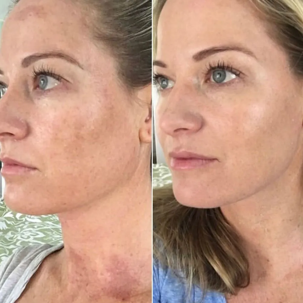 Customer review photo