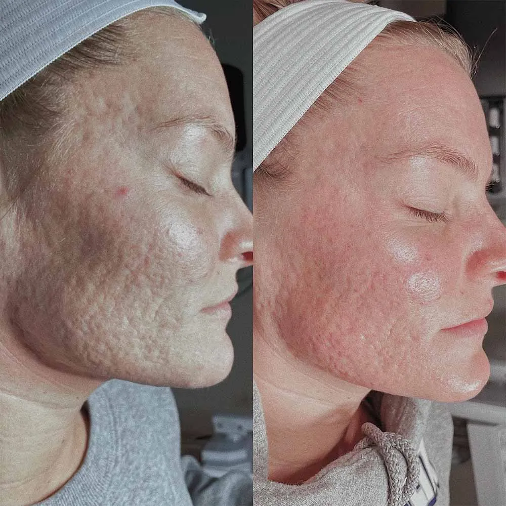 Customer review photo