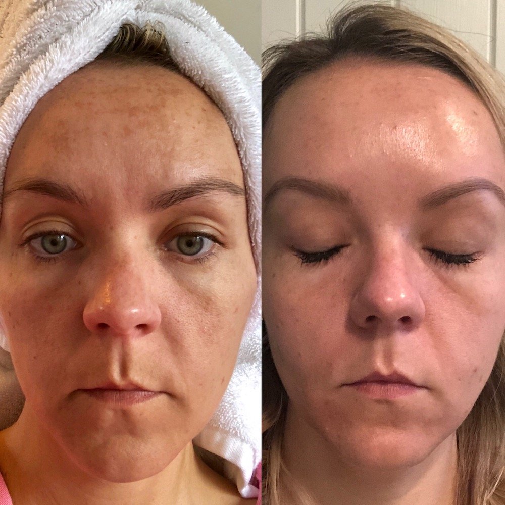 Customer review photo