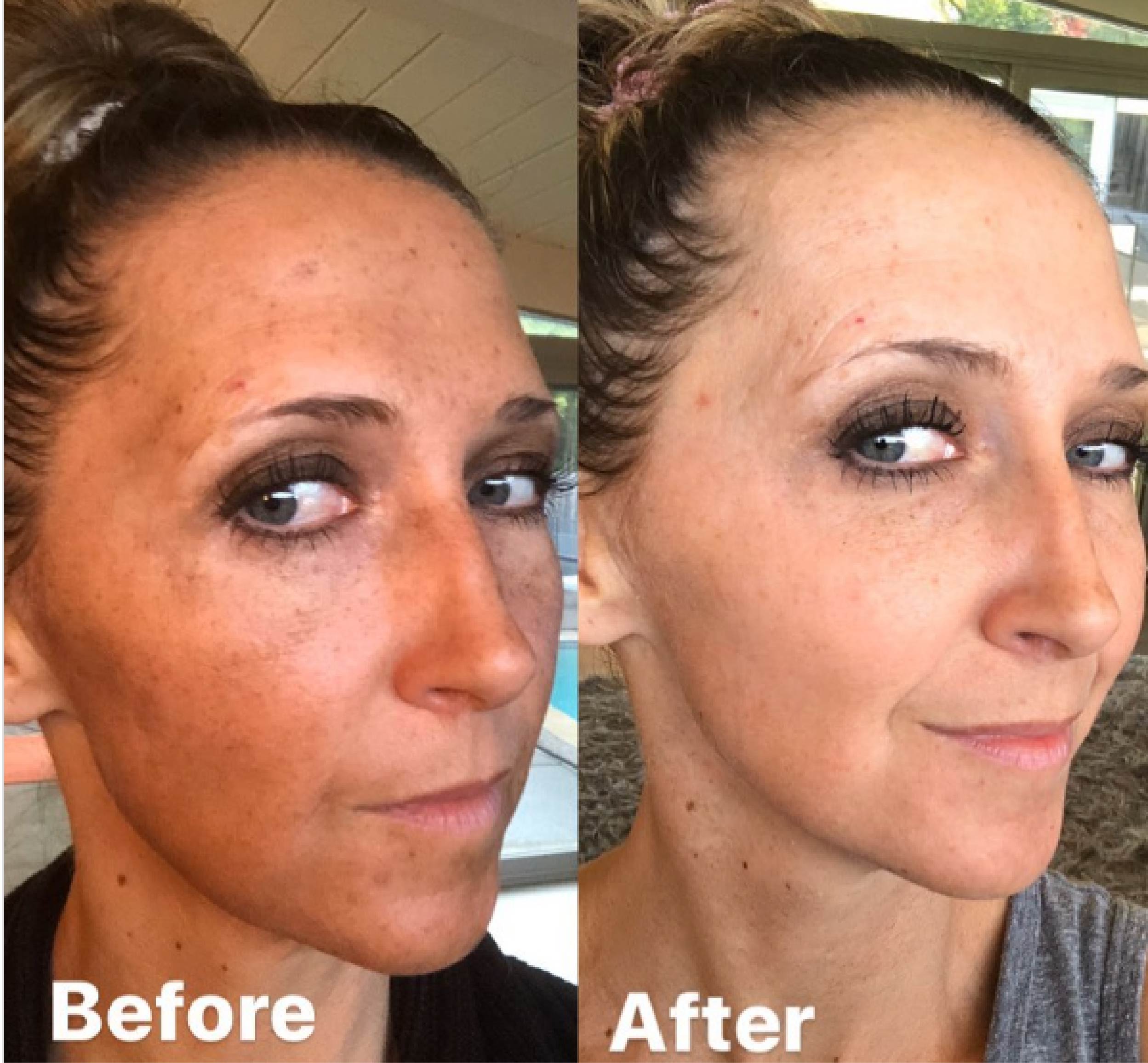 Customer review photo