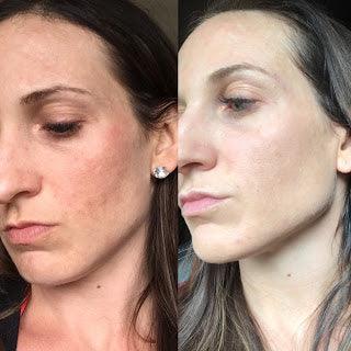 Customer review photo